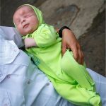 bebé-sin-ojos-adopción